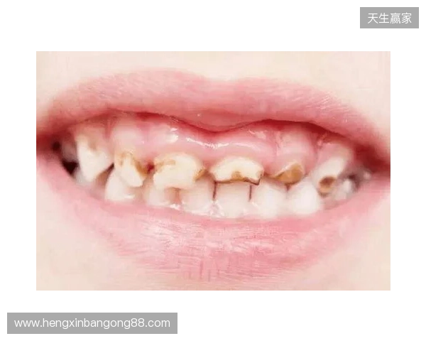 韦林顿确诊上唇部贯通伤；11、21牙半脱位；上颌前牙区牙槽骨骨折