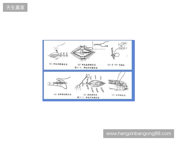 广州豹官方：杨浩眉弓伤口缝合30余针，预计5-7天后拆线